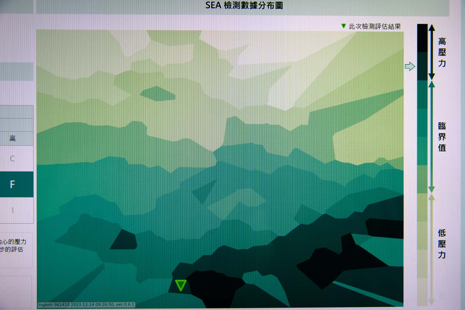 憂鬱症-輔助診斷-AI-臨床應用