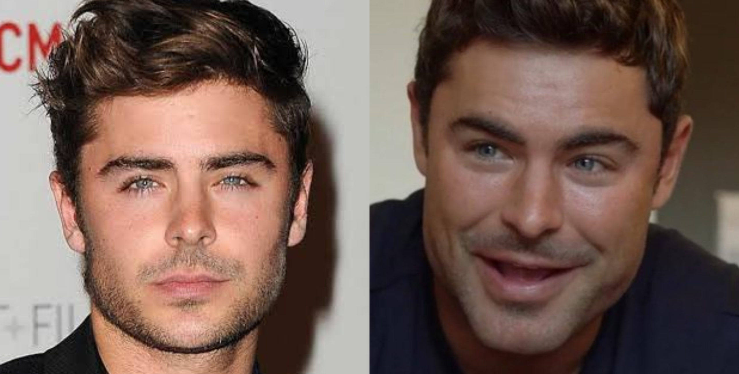 9fba2541 Zac Efron Cirujia Scaled 