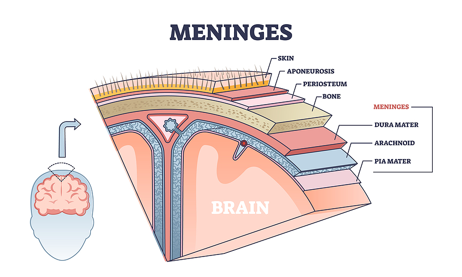 Durango meningitis