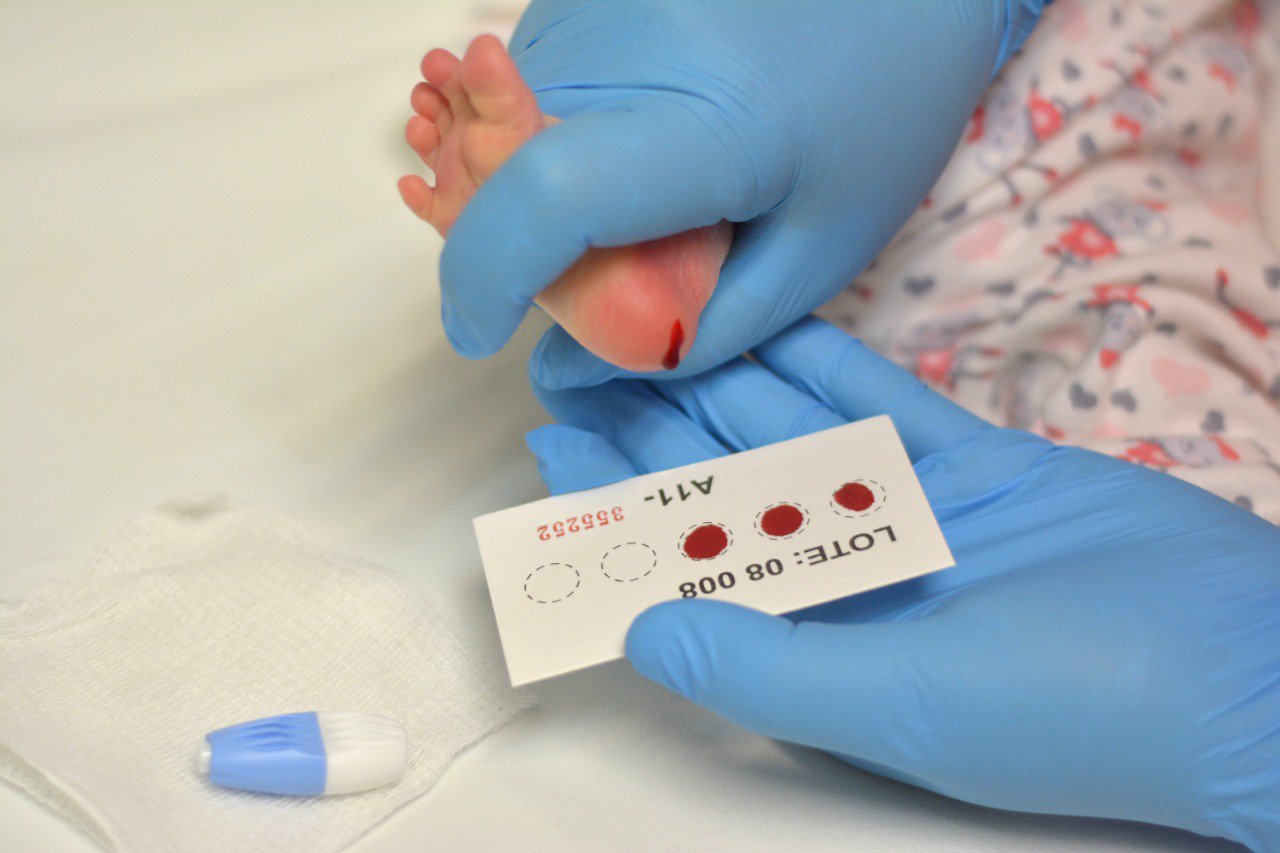 El Issste Aplicará Tamiz Neonatal Metabólico Ampliado En Recién Nacidos 2090