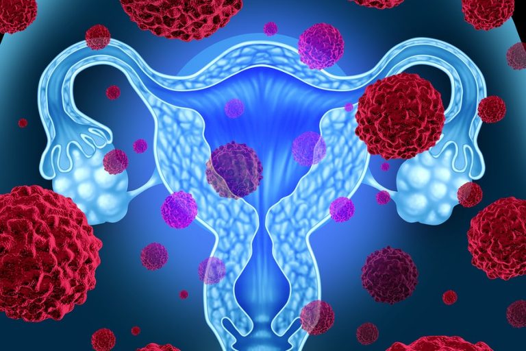Cáncer cervicouterino en México: avances en vacunación VPH y detección temprana