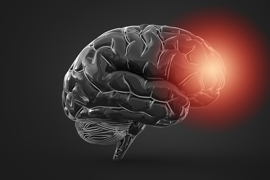 ¿Existen tratamientos naturales contra la atrofia cerebral?