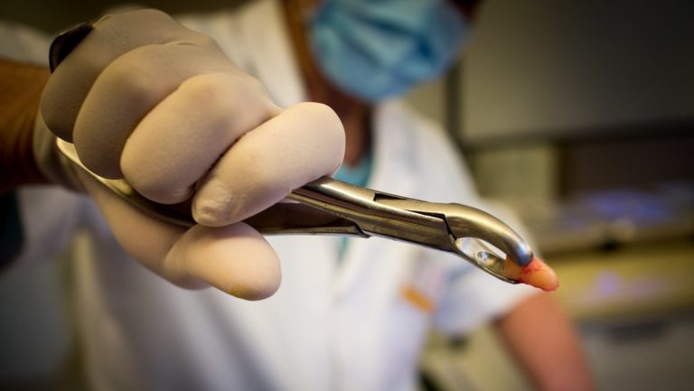 ¿Negligencia médica? Paciente muere dos semanas después de que le sacaran muela del juicio