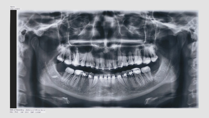 Las ayudas diagnosticas son indispensables en odontología