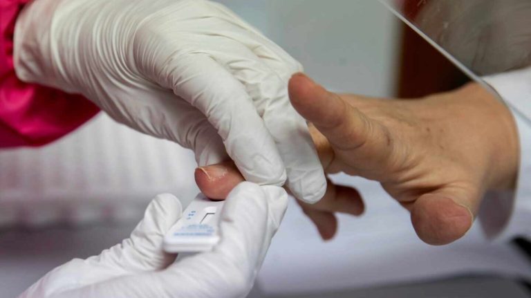 OJO: Salud alerta NO aplicarse prueba rápida de sangre para detectar COVID-19
