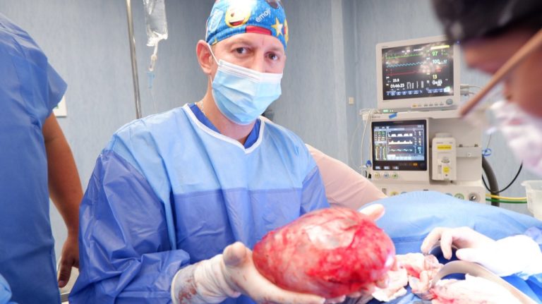 Caso clínico: Cirujanos extirpan un tumor quístico retroperitoneal gigante