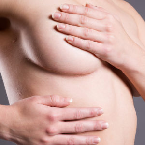 Mastectomía: Reconstrucción tras el tratamiento de cáncer