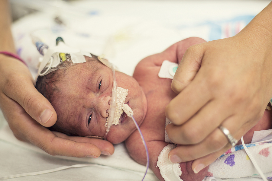 La prematuridad un problema creciente de salud pública