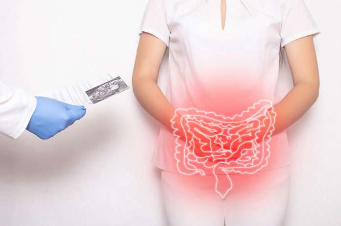 Síndrome de Colon Irritable secuela Covid-19