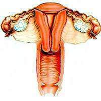 Endometriosis: ¿Existe un tratamiento adecuado? cáncer de cérvix