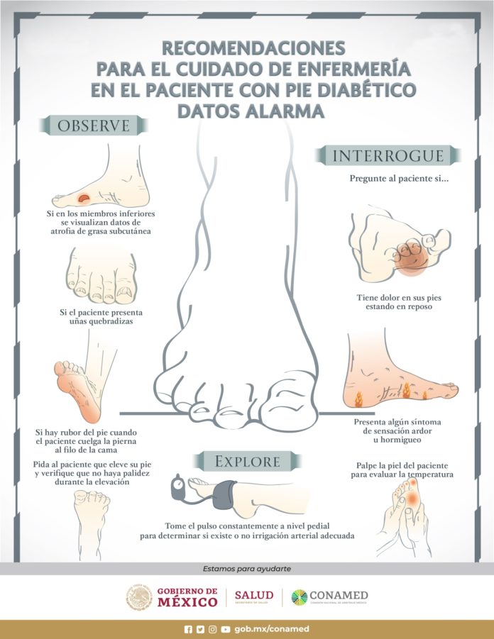 Consejos de Conamed para detectar el pie diabético en tus pacientes