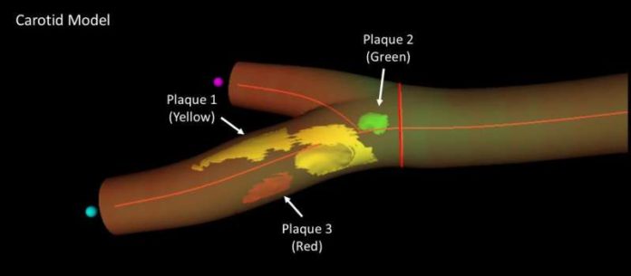 ecografía vascular 3D