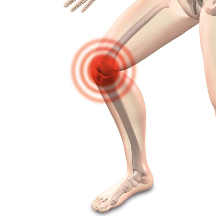 osteoartrosis