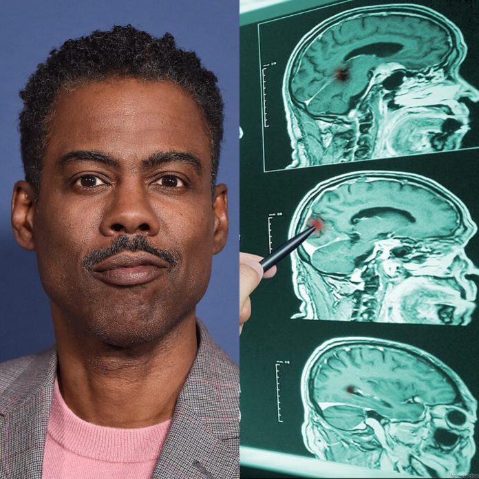 chris rock sindrome