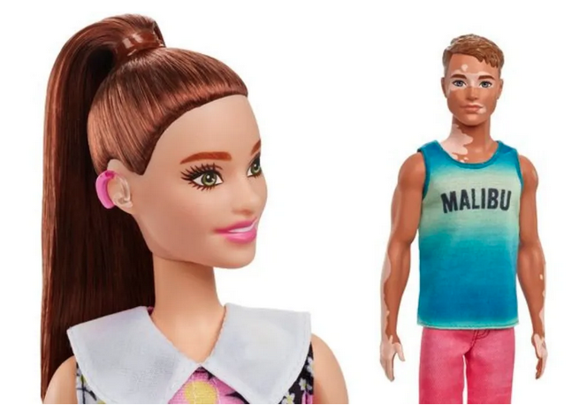 barbie vitiligo