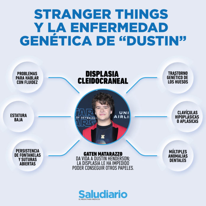 Stranger Things displasia cleidocraneal