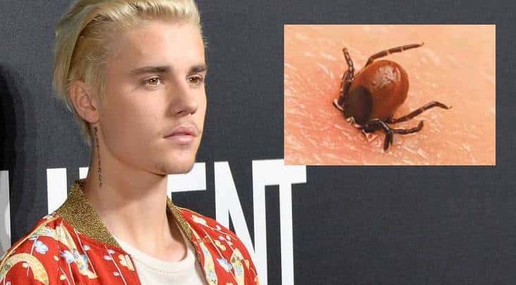 Esta es la enfermedad por la que Justin Bieber se apartó de los reflectores