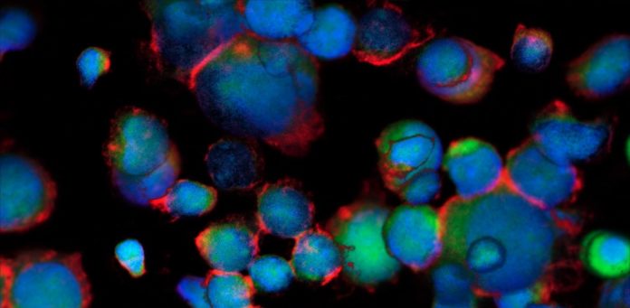 24 de Septiemrbe: Día Mundial de la Investigación Contra el Cáncer