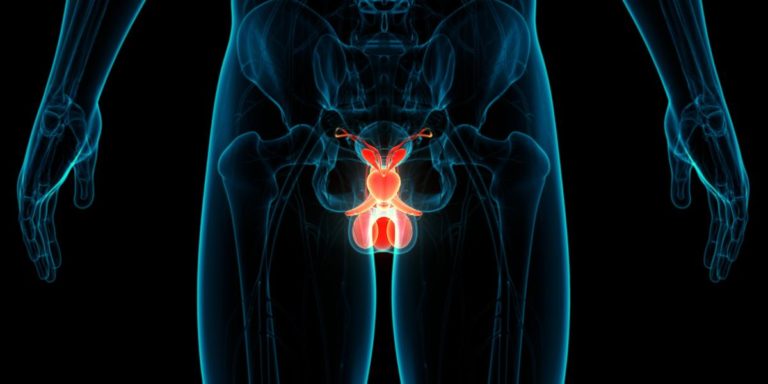 ¿Cómo es la experiencia de detección de cáncer de próstata en México?