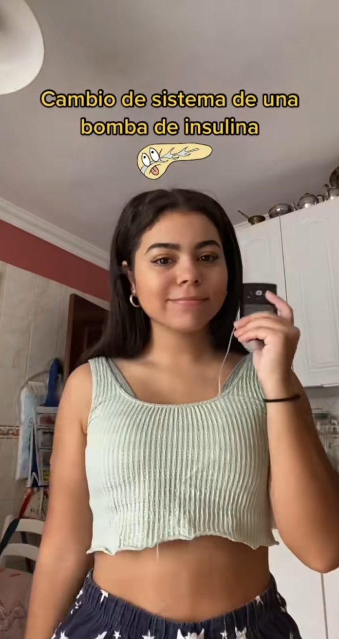 Joven comparte en TikTok cómo es vivir con diabetes tipo 1