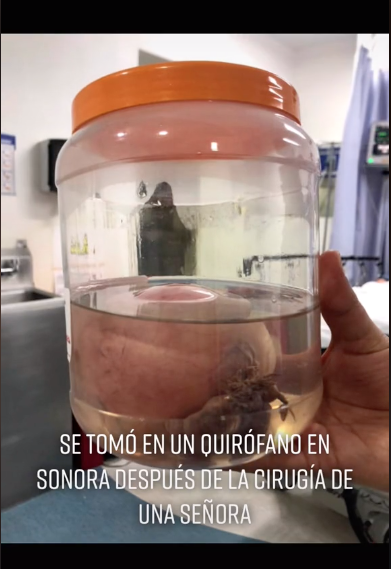 Doctor comparte foto donde aparece forma de la muerte en un quirófano