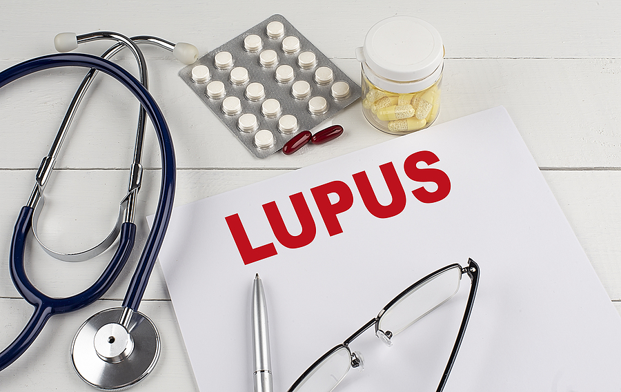 Científicos descubren posible nuevo tratamiento para lupus