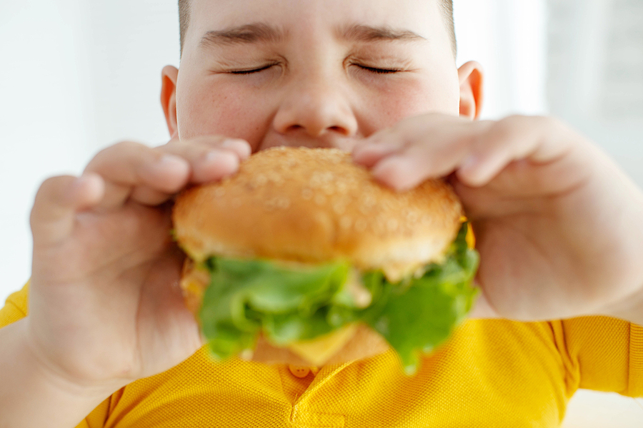 obesidad infantil