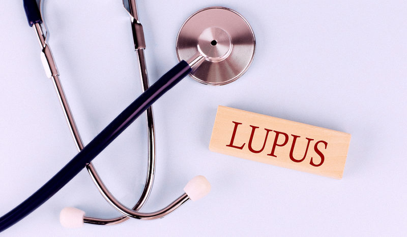 lupus enfermedad mujeres