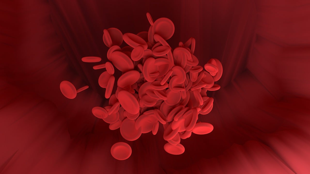 anemia falciforme