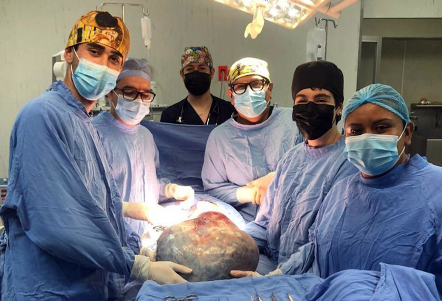 Cirujanos del IMSS retiran un tumor ovárico gigante de 21 kilos