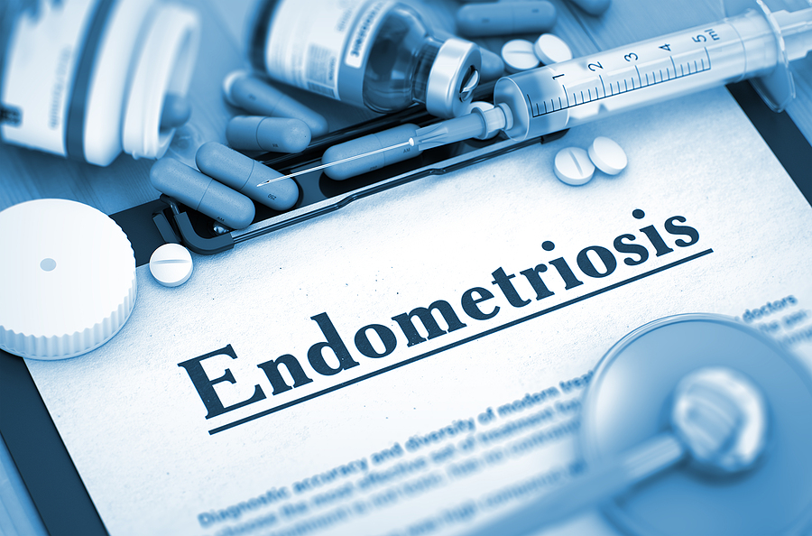 Endometriosis en México: 1 de cada 10 mujeres en edad reproductiva la padece