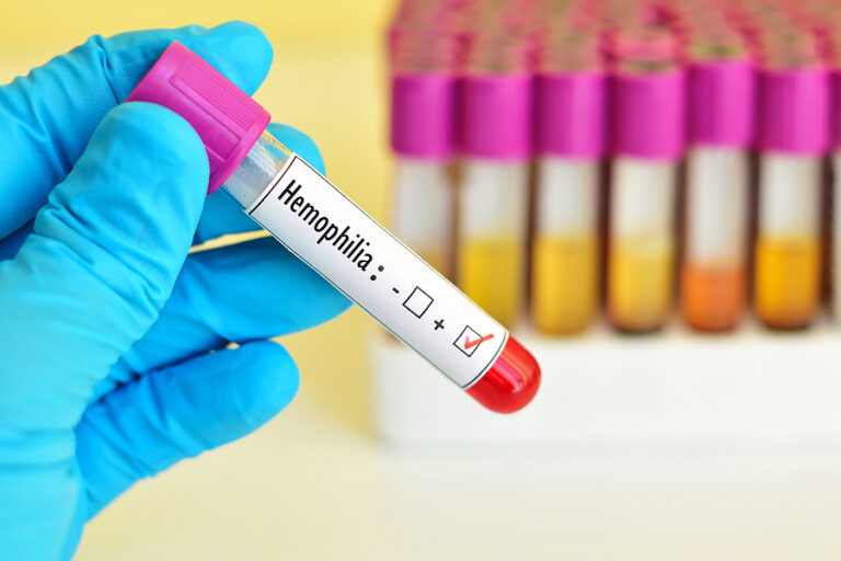 Día Mundial de la Hemofilia 2024. ¿Por qué se conmemora el 17 de abril?