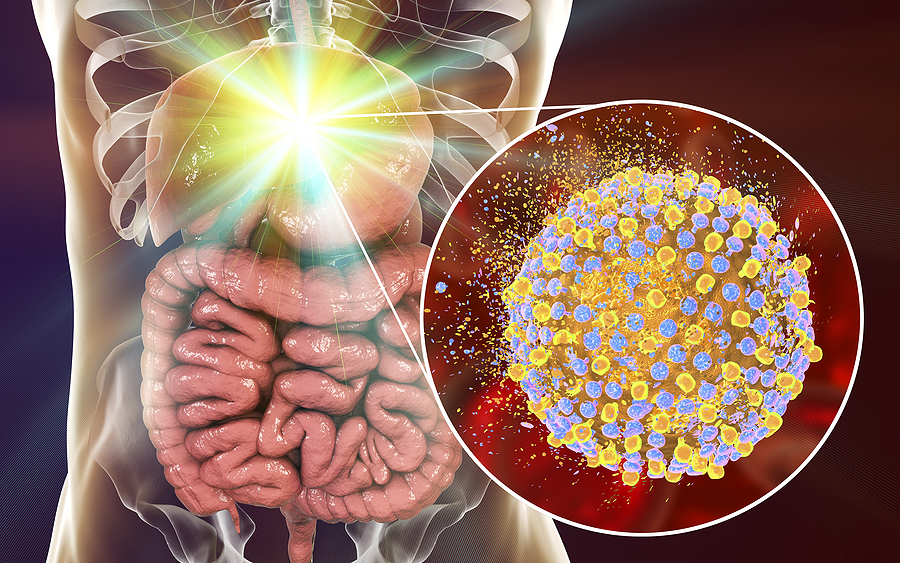 Hepatitis es la segunda enfermedad vírica más mortal del mundo