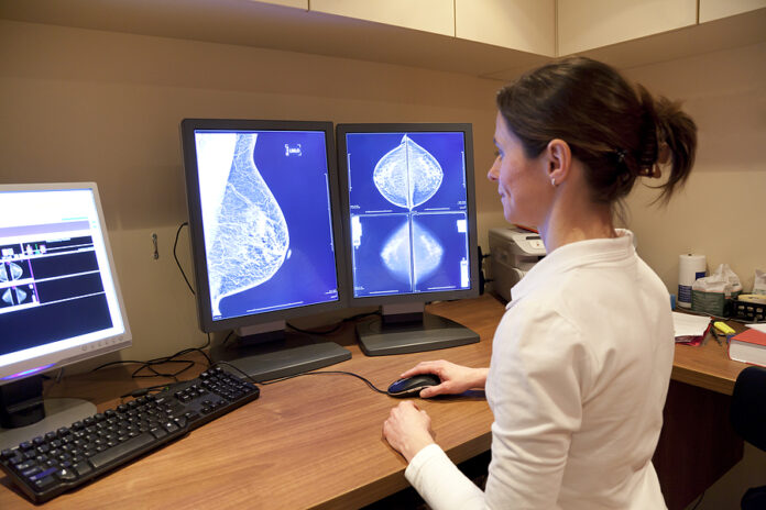 Cáncer de mama: Las mejores pruebas médicas para su detección