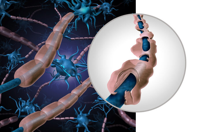 ISSSTE ofrece 12 tratamientos contra la Esclerosis Múltiple