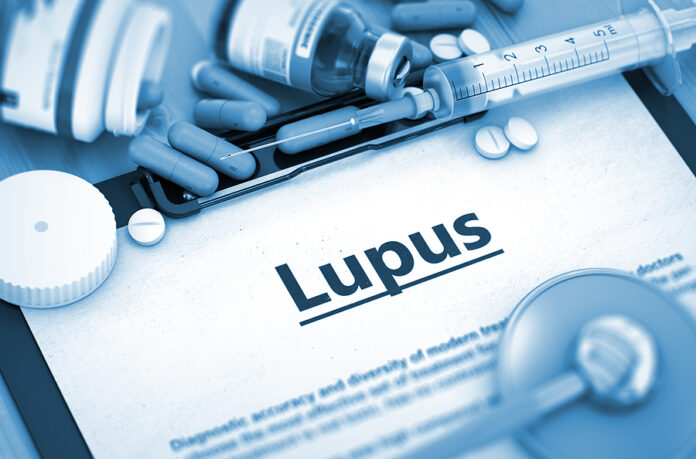 Día Mundial del Lupus: Una enfermedad sin cura pero que se puede controlar