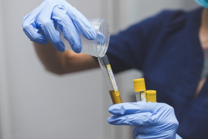 Pruebas antidoping: 5 datos curiosos que pocos conocen