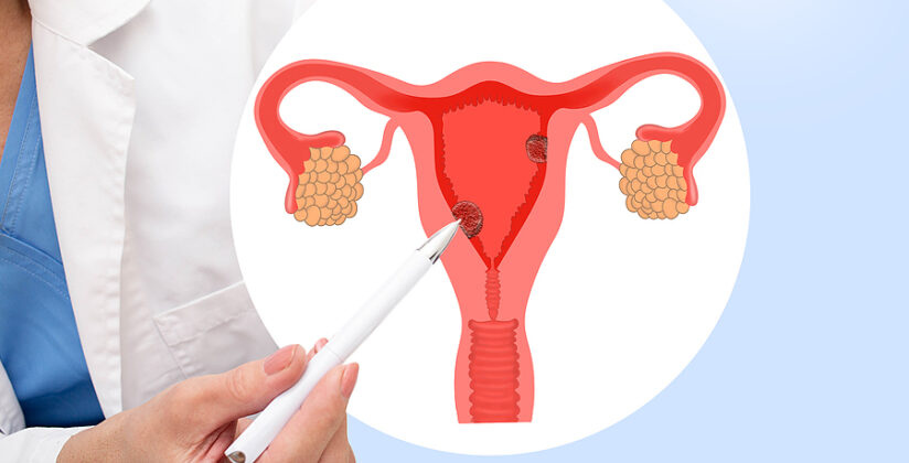 Cofepris autoriza un medicamento biotecnológico contra el cáncer de endometrio