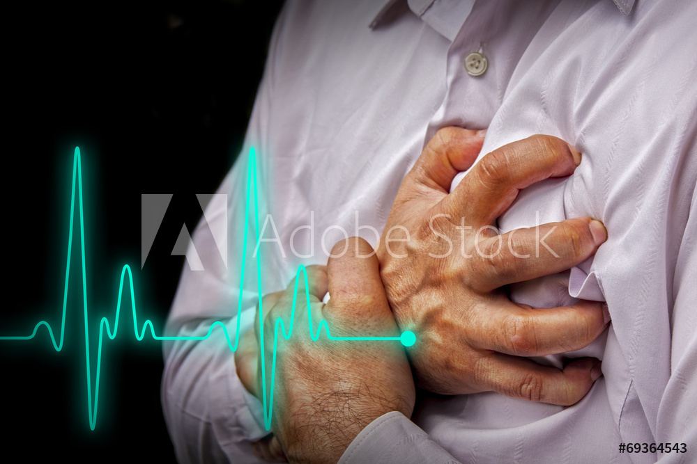 Heart Attack