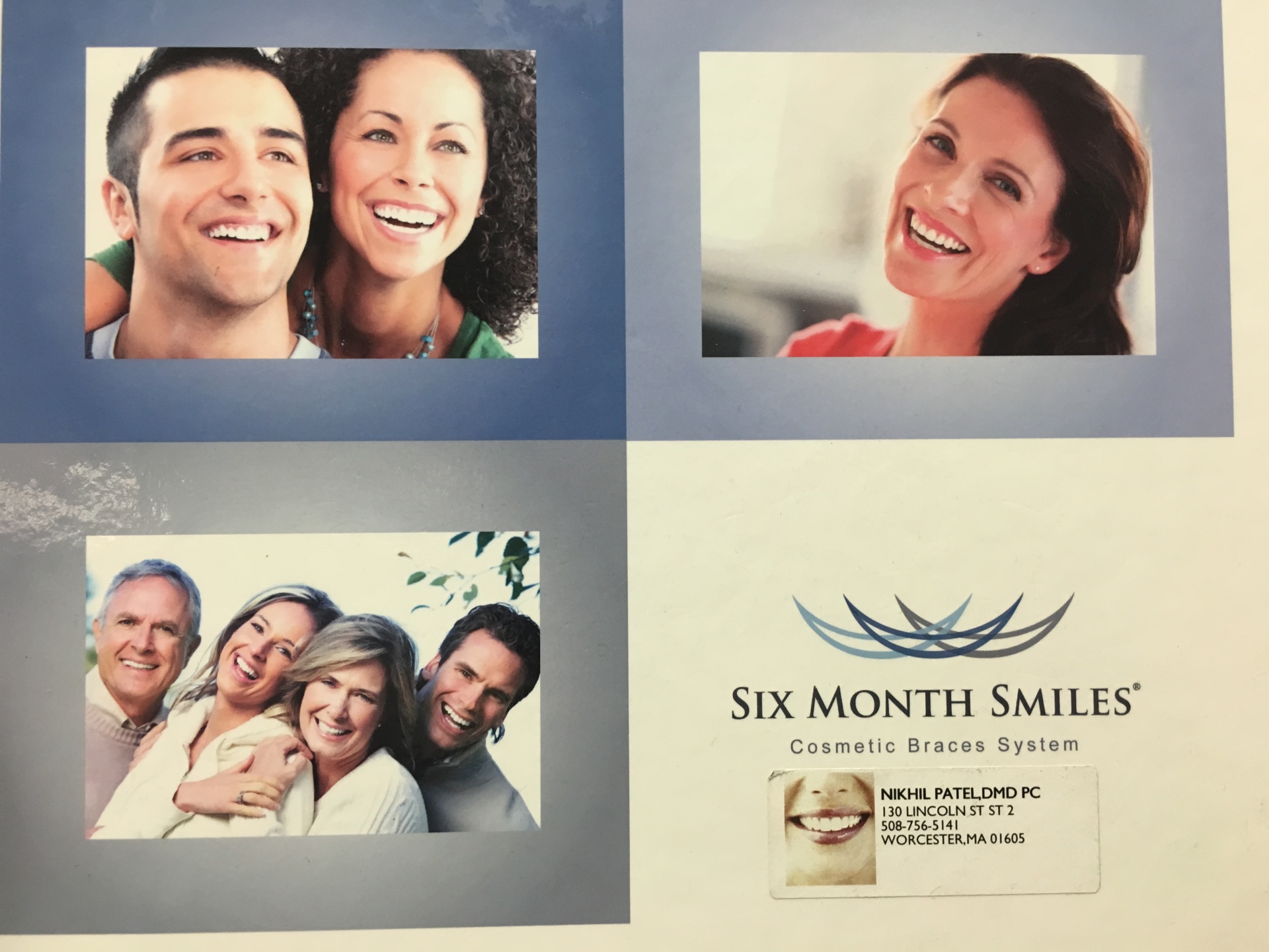 Braces Six Month Smile Teeth Whitening