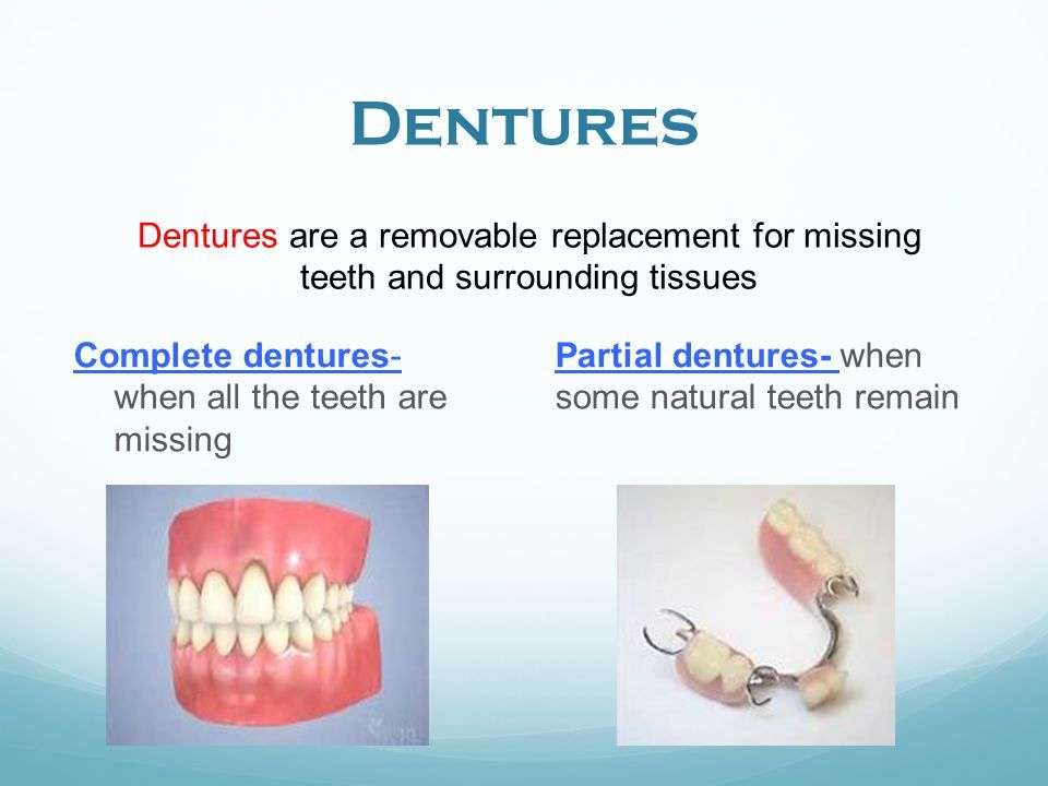 DenturesDenturesarearemovablereplacementformissingteethandsurroundingtissues.Completedentures-whenalltheteetharemissing.