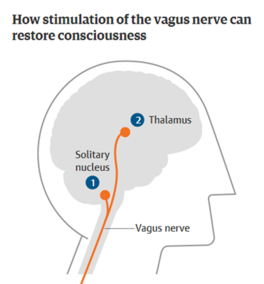 Can Light Stimulation of the Vagus Nerve Affect Brain Function?