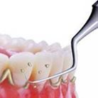 PERIODONCIA