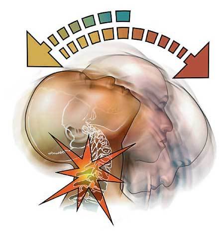 Whiplash Soreness Chiropractor Aurora Colorado Expert Insurance