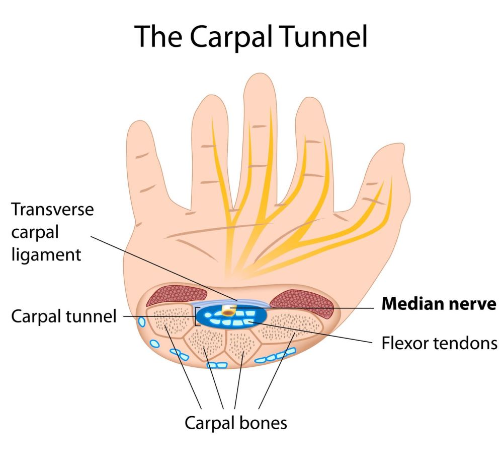 Carpal Tunnel Relief Chiropractic adjustment