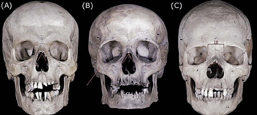 Re Establishing A Foundation For Craniometry