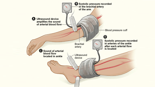 6 Month Check Up with Vascular Surgeon