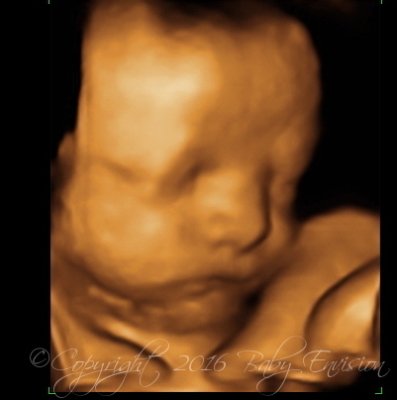 7 week ultrasound 3d