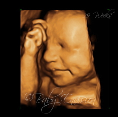 29 weeks fetus ultrasound