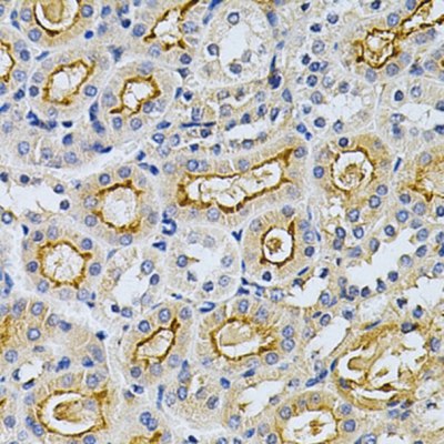 Polyclonal, Monoclonal & Secondary Antibodies